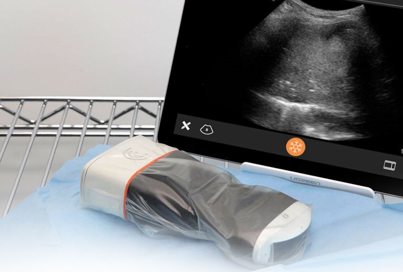 Aparaty USG – ultrasonograficzne urządzenia diagnostyczne